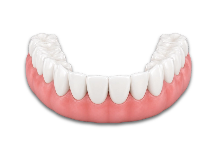 Carillas de zirconio Carillas de zirconio