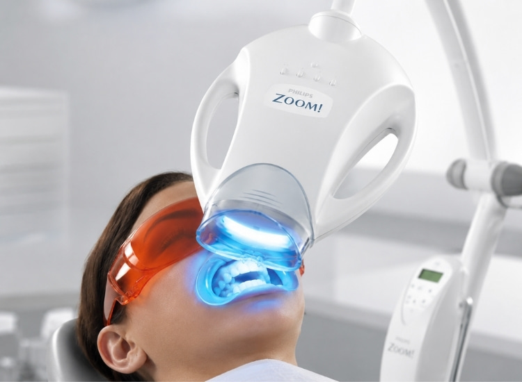 Blanqueamiento dental en clínica Blanqueamiento dental en clínica