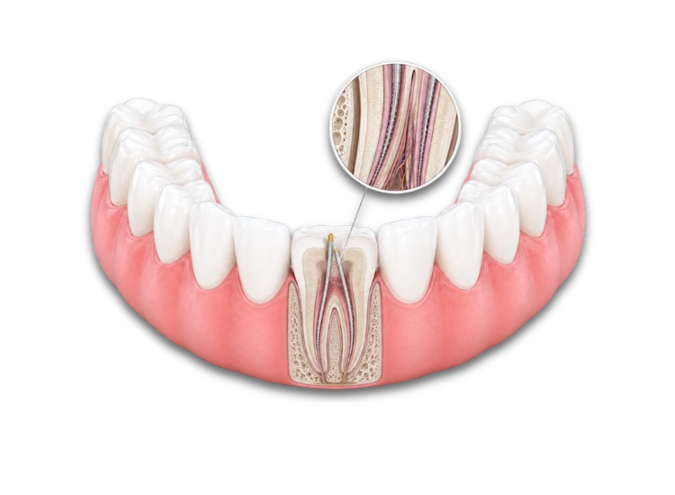 Endodoncia con microscopio