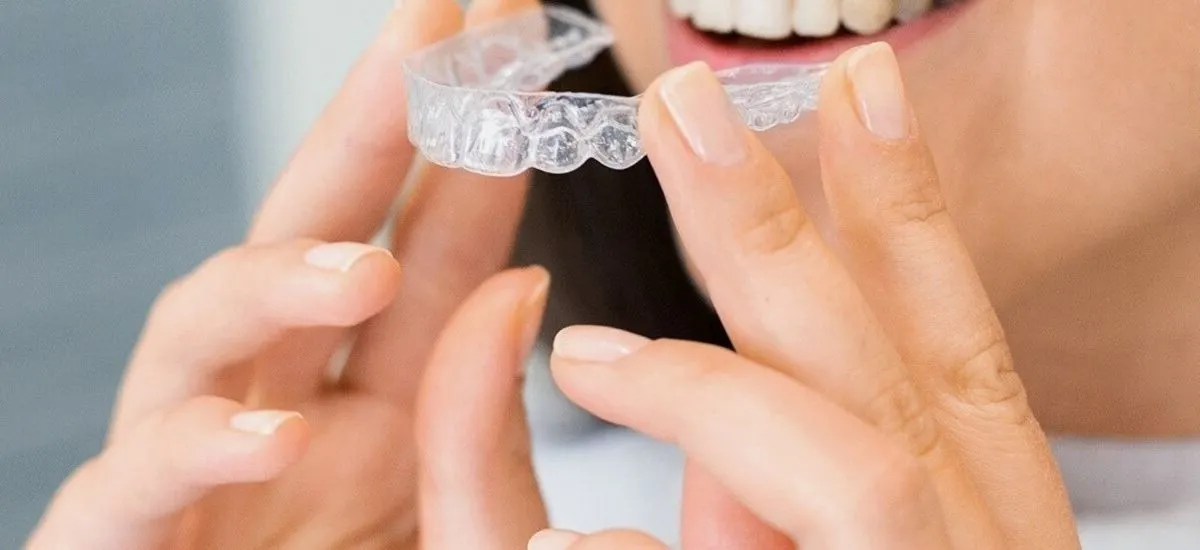 Persona colocando un alineador transparente sobre sus dientes como tratamiento de ortodoncia invisible.